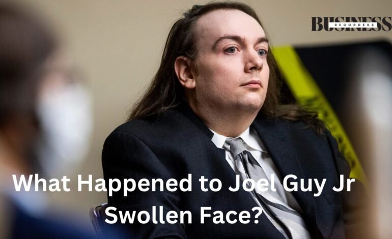 what happened to joel guy jr swollen face